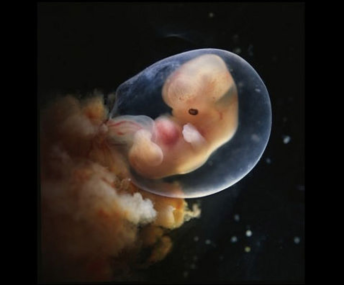 эмбрион 7 недель