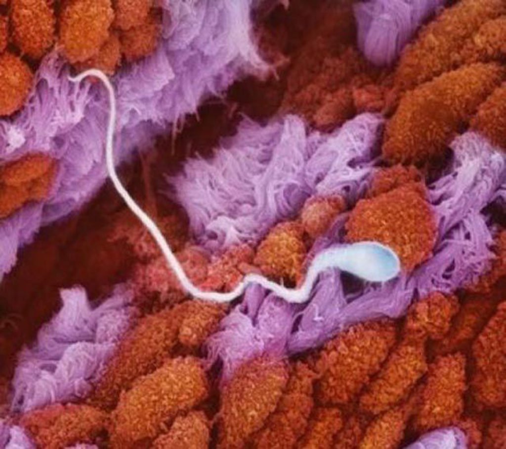 Сперматозоид в маточной трубе